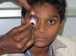 Orbit & Oculoplasty